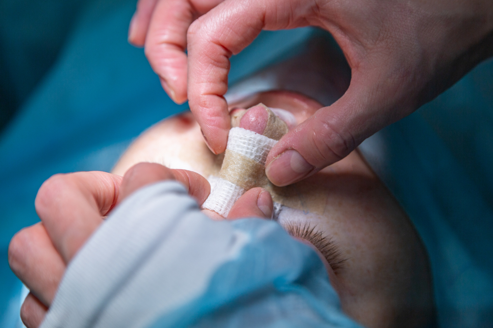 Procedure Image